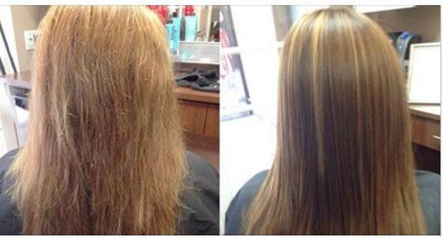 Dyukre neoptid la loción de la caída de los cabello a los hombres las revocaciones